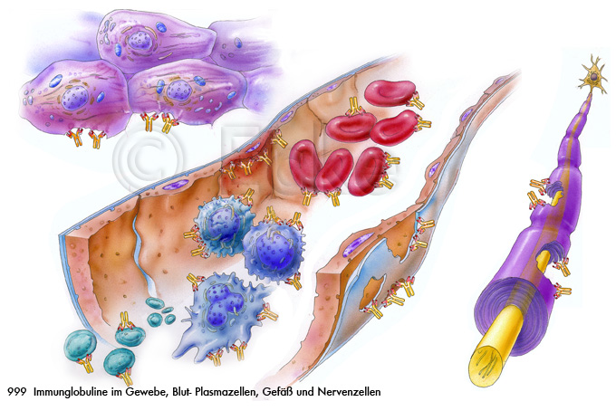 Angriffsorte Antikoerper Immunglobuline T-Zelle Erythrozyten Makrophage B-Zellen Gefaess-Endothel Gewebezellen