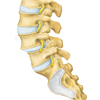 Spondylolisthese