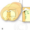 Neurogenese Parkinson