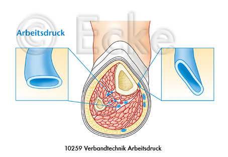 Arbeitsdruck