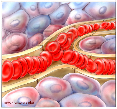 Erythrozyten viskos