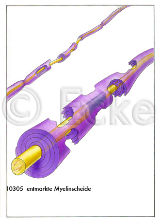 Myelinscheide entmarkt