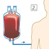 EPO Eigenblut Doping