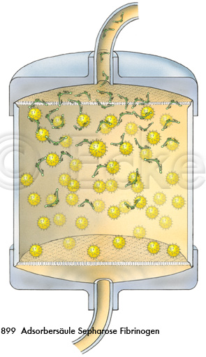 Adsorbersaeule Sepharose Fibrin