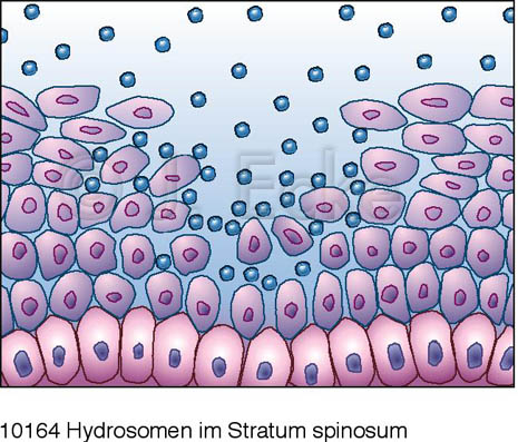 Stratum Spinosum