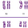 Chromosomen Metaphase