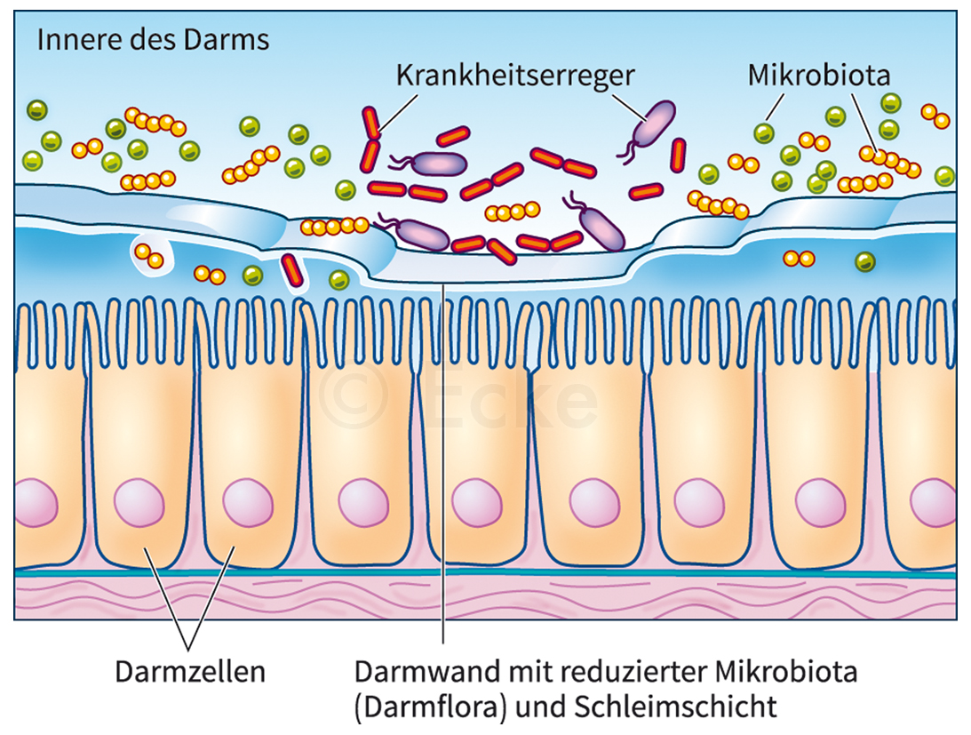 Mikrobiom Darmschleimhaut Immunstimulation Darm-Lungen-Achse